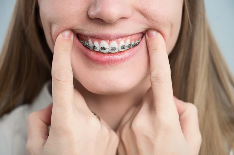Orthognathic jaw surgery planning