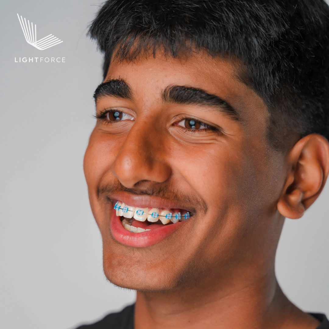 Why patients choose LightForce braces at our office